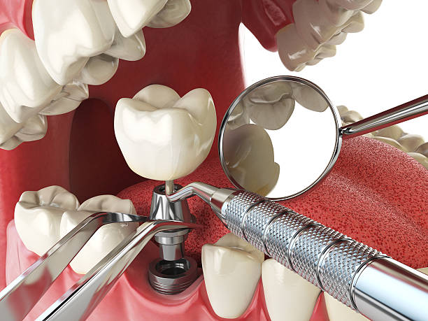 Best Urgent Care for Lost Fillings or Crowns in Middleport, OH