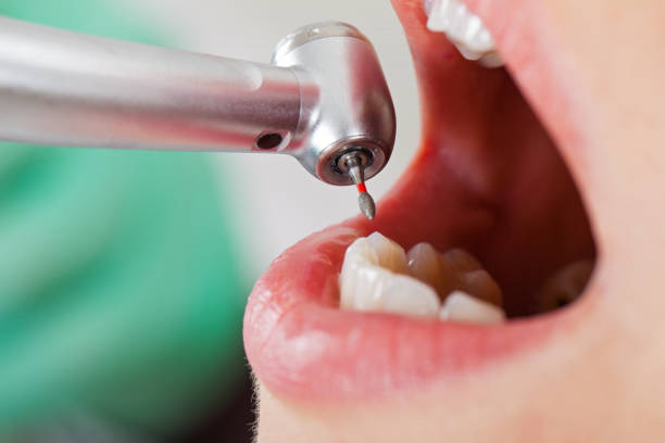 Best Pediatric Emergency Dentist in Middleport, OH
